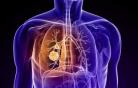 肺癌术后护理方法有哪些